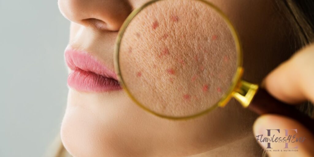 Skin Treatments in Kharadi Expert Skincare Clinic in Kharadi Pune Flawless4ever Beauty with Flawless4ever