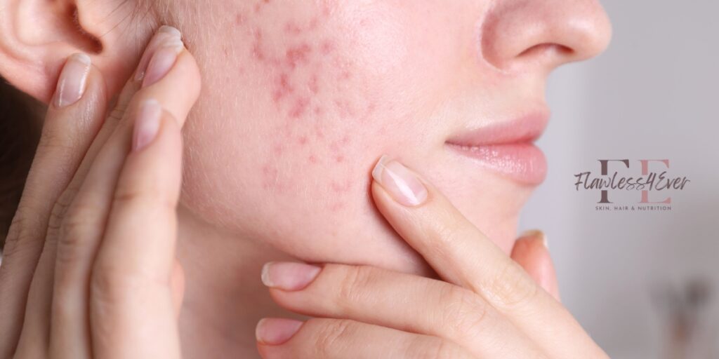 Top 7 Skin Problems You Shouldn’t Ignore - And How to Treat Them 1 Top 7 Skin Problems You Shouldn’t Ignore - And How to Treat Them
